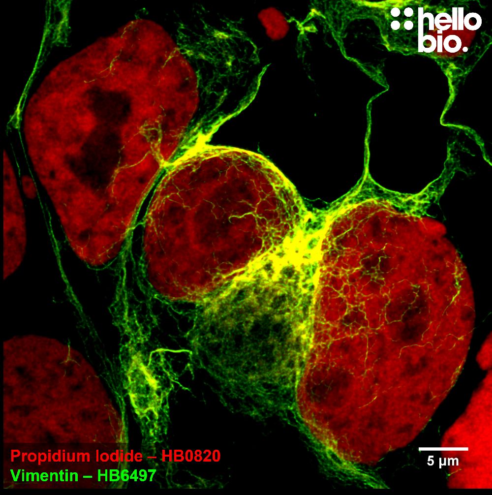 Figure 3. Vimentin and Propidium lodide co-staining in HEK293T cells