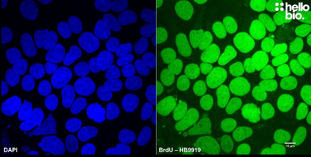 Figure 2. BrdU immunoreactivity in cultured HEK293T cells