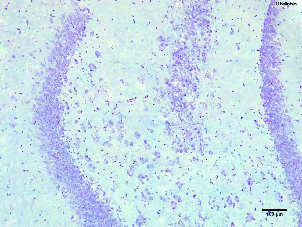 Figure1. Cresyl Violet staining in formalin fixed rat dentate gyrus