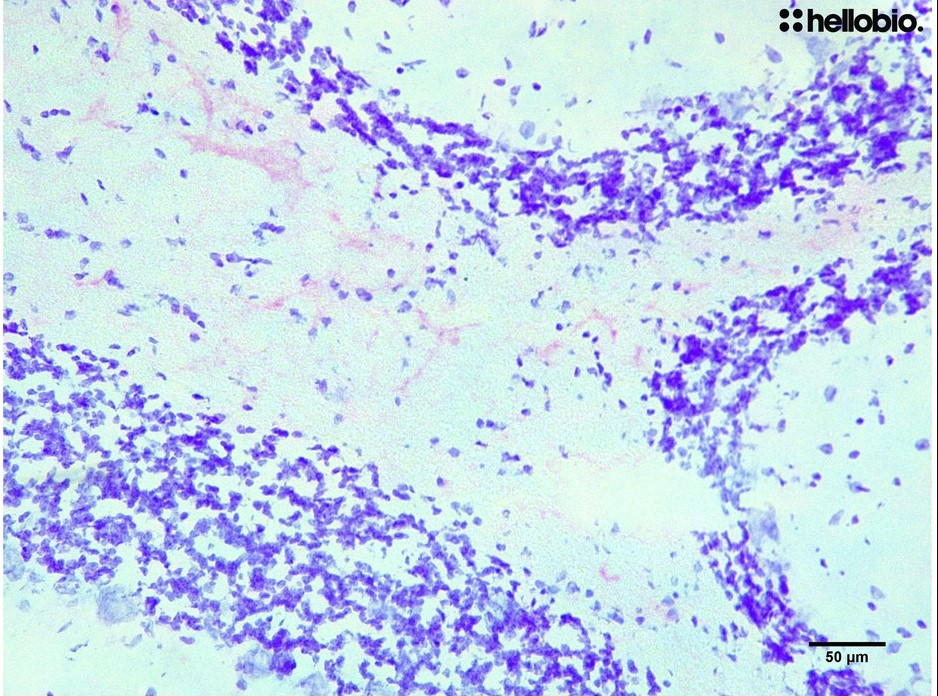 Figure8. Cresyl Violet staining in formalin fixed rat cerebellum