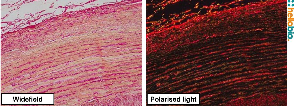 Figure 10. Picro Sirius red staining in formalin fixed Chimpanzee aorta 