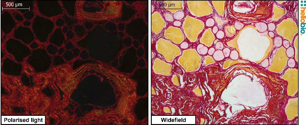 Figure. 2: Picro Sirius red staining in toad skin under both standard widefield illumination and polarised light. 