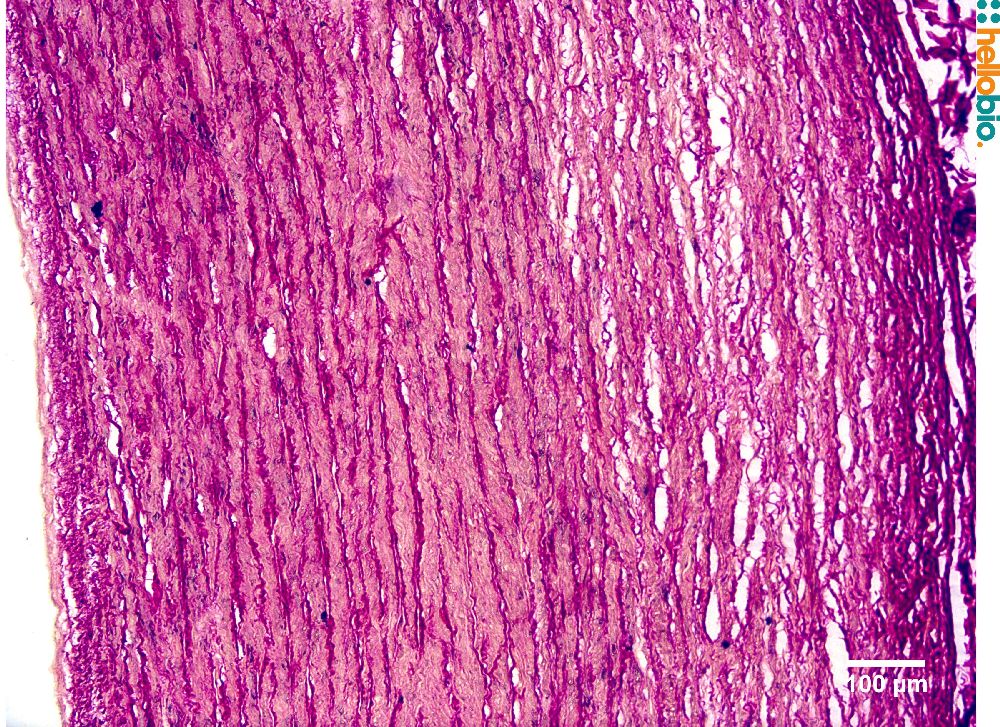 Figure. 4: Picro Sirius red staining in chimpanzee aorta. 