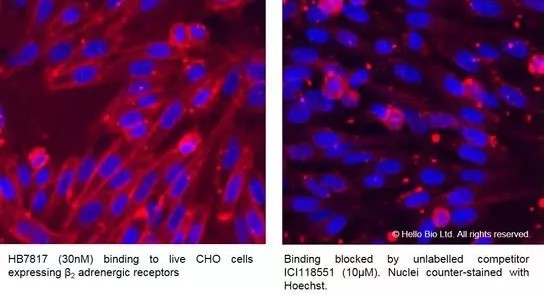 Fluorescence imaging with HB7817