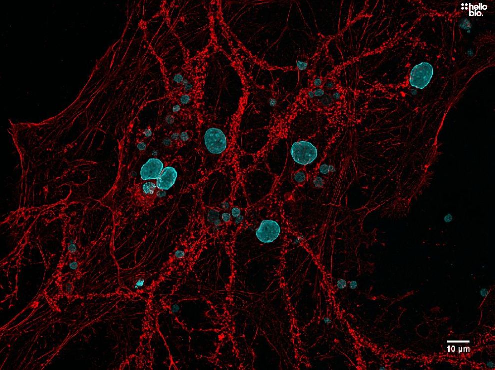 Figure. 3: Rhodamine Phalloidin TRITC and DAPI co-staining in neuronal cell culture. 