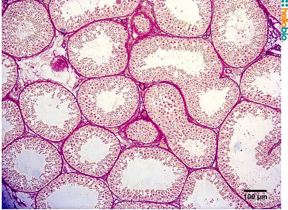 Figure. 6: Picro Sirius red staining in chimpanzee testicle. 