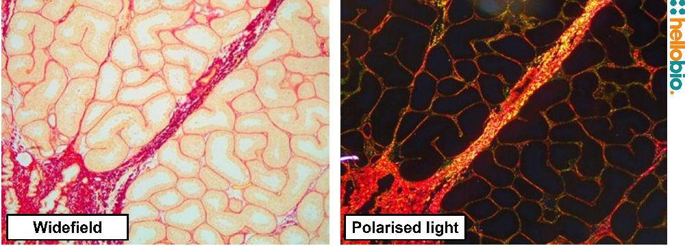 Figure. 13: Picro Sirius red staining in Bouins fixed Chimpanzee testis under both standard widefield illumination and polarised light. 