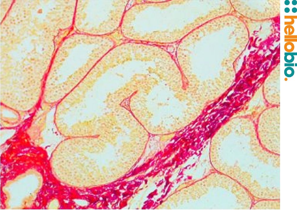 Figure. 14: Picro Sirius red staining in bouins fixed Chimpanzee testis. 