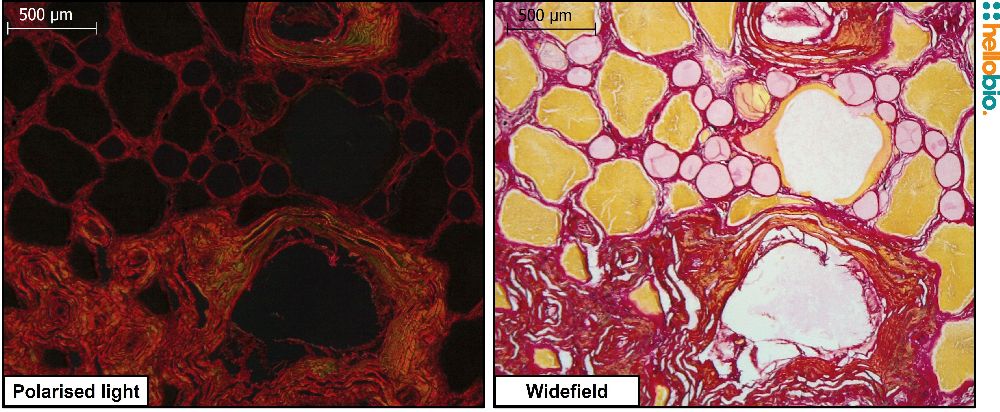 Figure. 2: Picro Sirius red staining in toad skin under both standard widefield illumination and polarised light. 