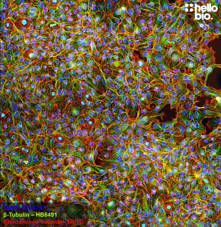 Figure 3. β-tubulin staining in HEK293T cells. Mounted using MightyMount<sup>TM</sup> Antifade Fluorescence Mounting Medium with Phalloidin-TRITC (aqueous).