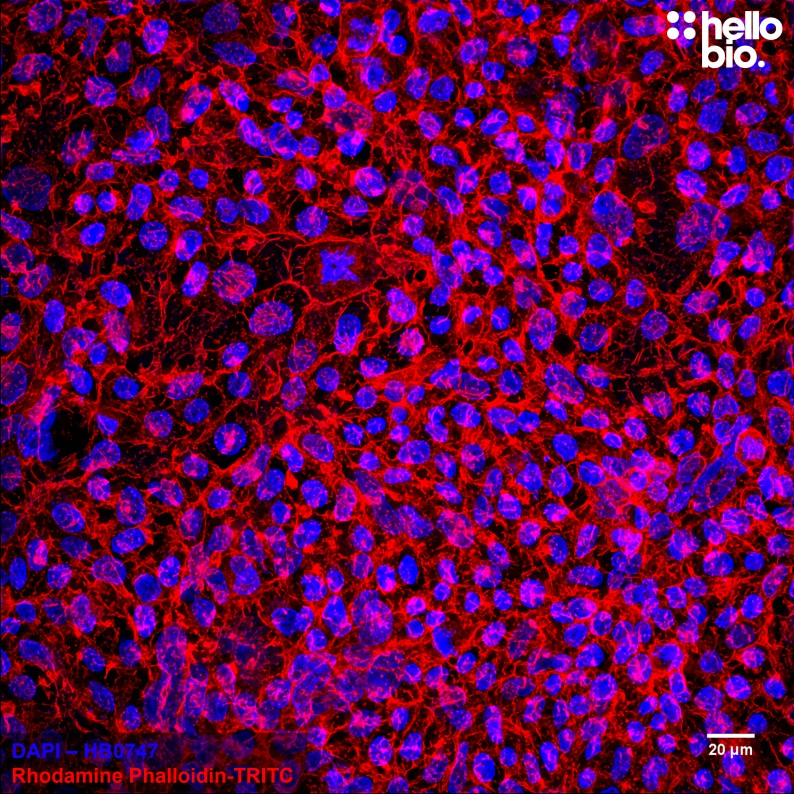 Figure 5. Fixed HEK293T cells mounted using MightyMount<sup>TM</sup> Antifade Fluorescence Mounting Medium with Phalloidin-TRITC (aqueous).