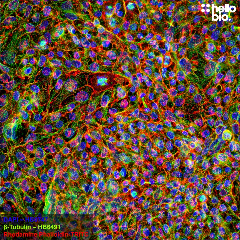 Figure 6. β-tubulin staining in HEK293T cells. Mounted using MightyMount<sup>TM</sup> Antifade Fluorescence Mounting Medium with Phalloidin-TRITC (aqueous).