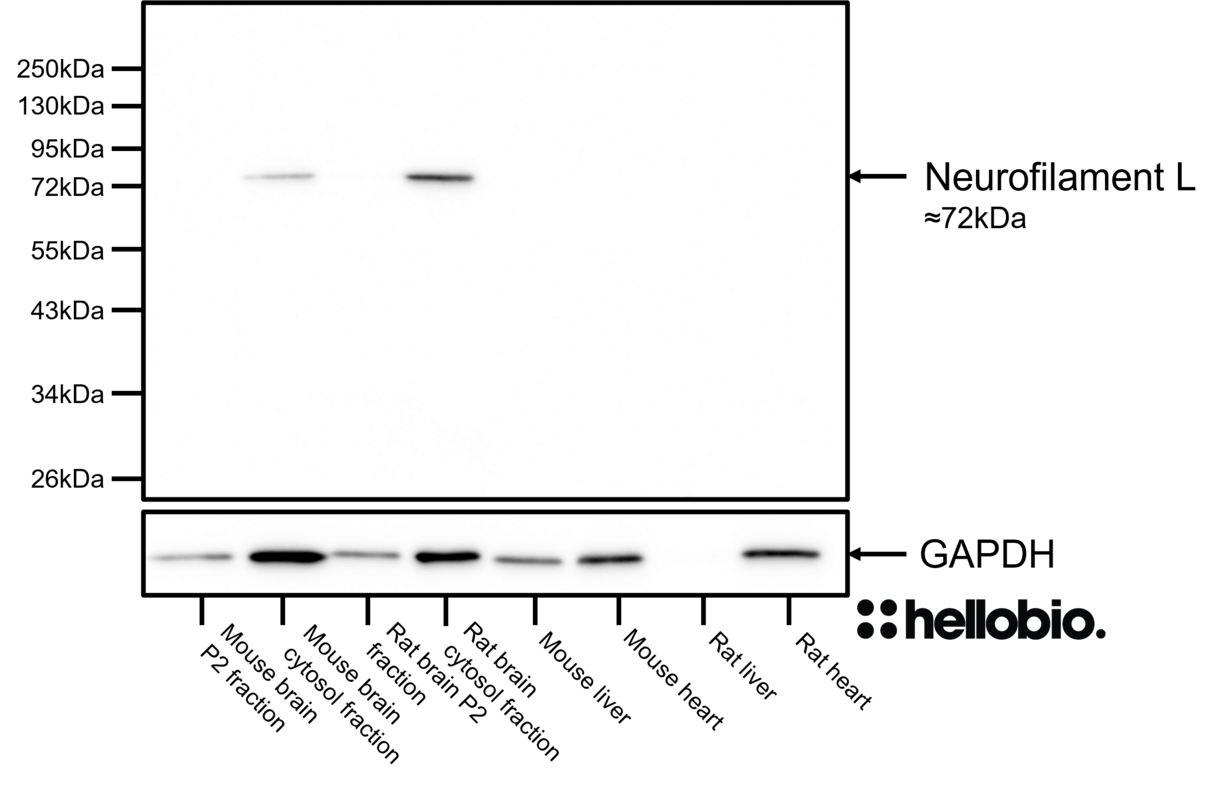 Figure 5. Neurofilament L expression in various tissue lysates and preparations.