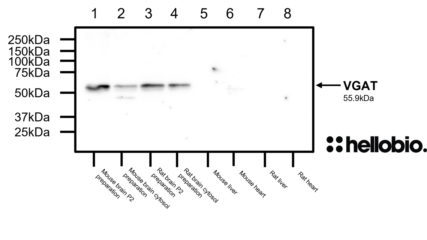 Figure 7. VGAT expression in various tissue lysates and preparations.