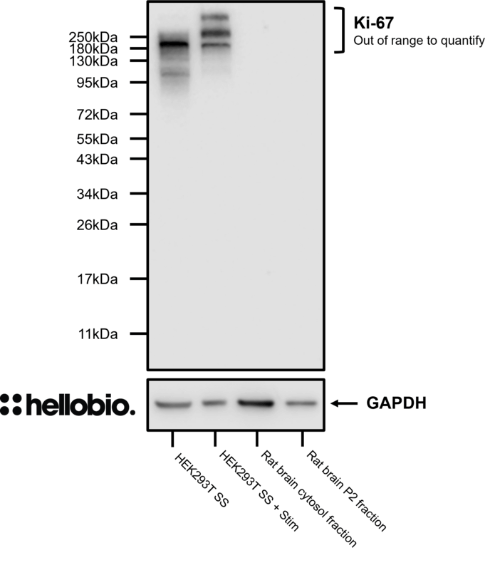 Figure 6. Ki-67 expression is rescued by 20% FBS stimulation in serum starved HEK293T cells.