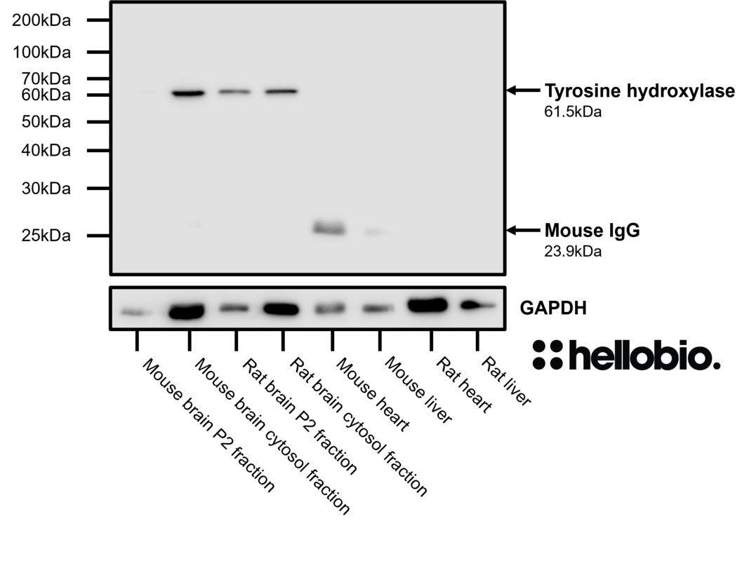 Figure 9. Tyrosine hydroxylase expression in various tissue lysates and preparations.