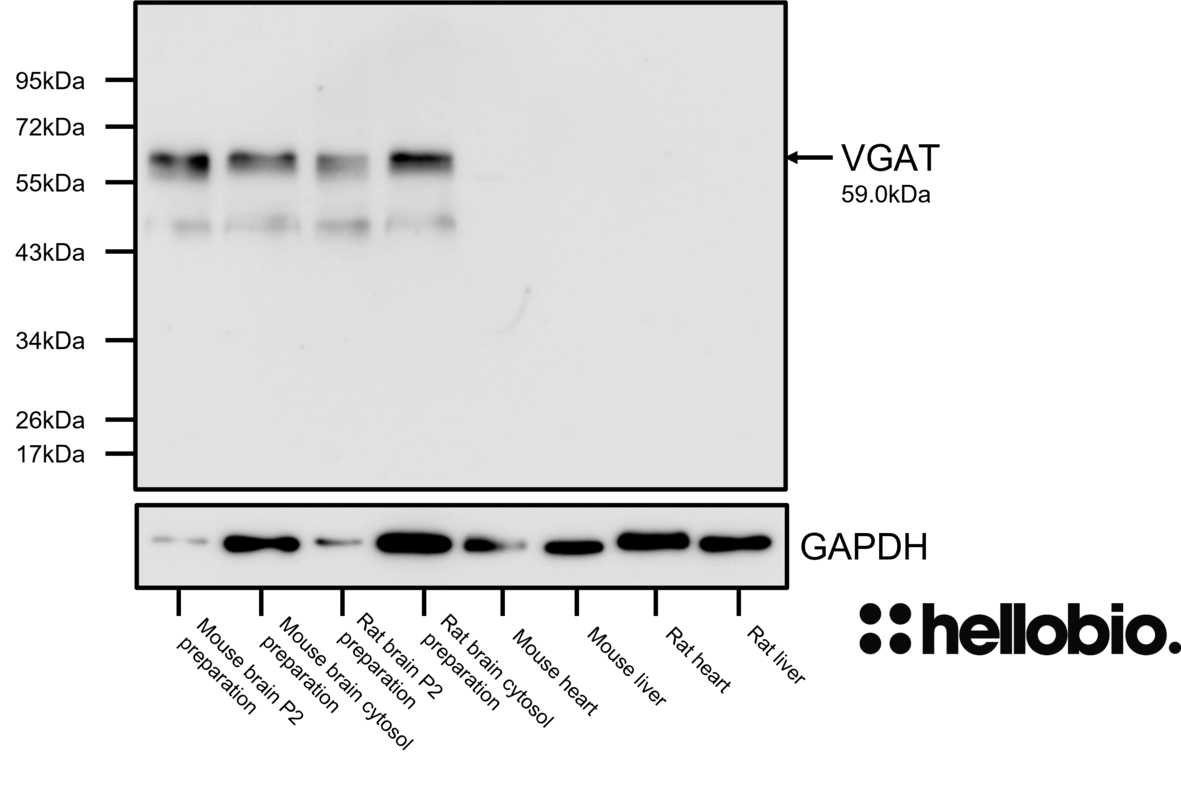 Figure 8. VGAT expression in various tissue lysates and preparations.