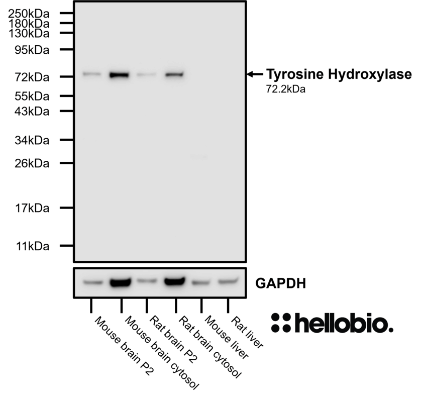 Figure 4. Tyrosine hydroxylase expression in various tissue lysates and preparations (MES buffered Bis-Tris gel).