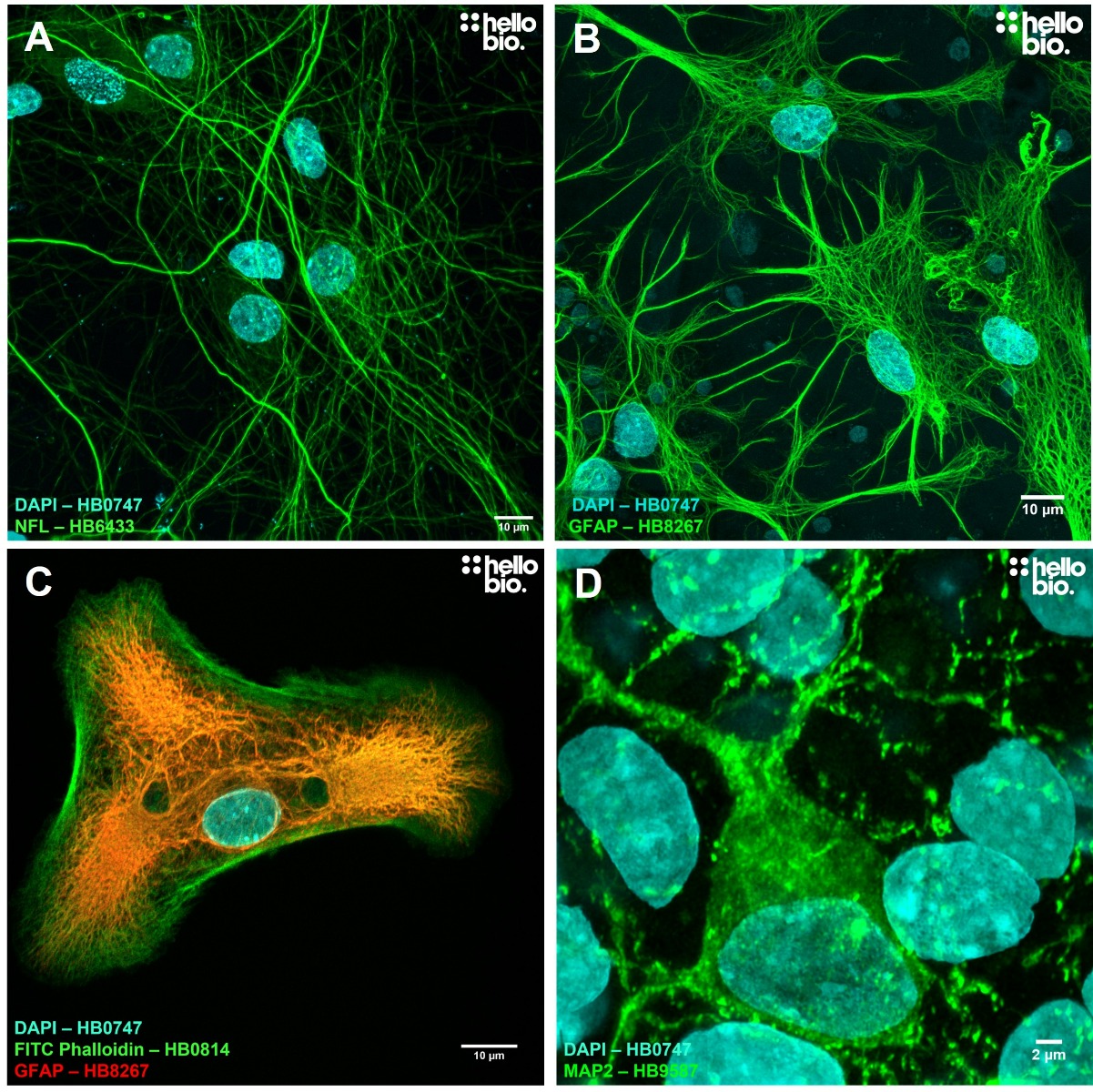 Figure 1. Example ICC images from cultured rat neurones using Hello Bio antibodies
