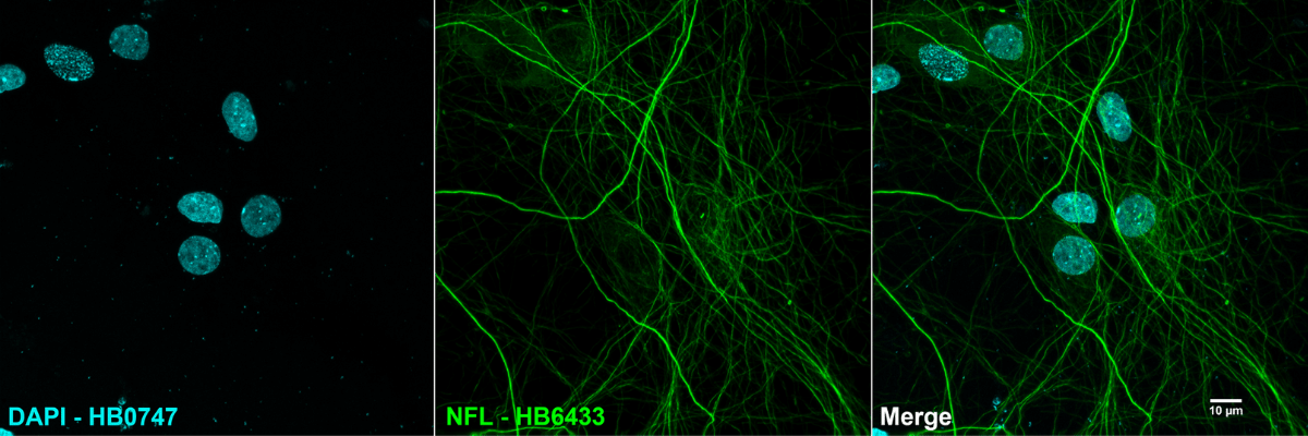 immunocytochemistry using fluorescent detection